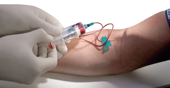 Eigenbluttherapie, die am Arm angewendet wird