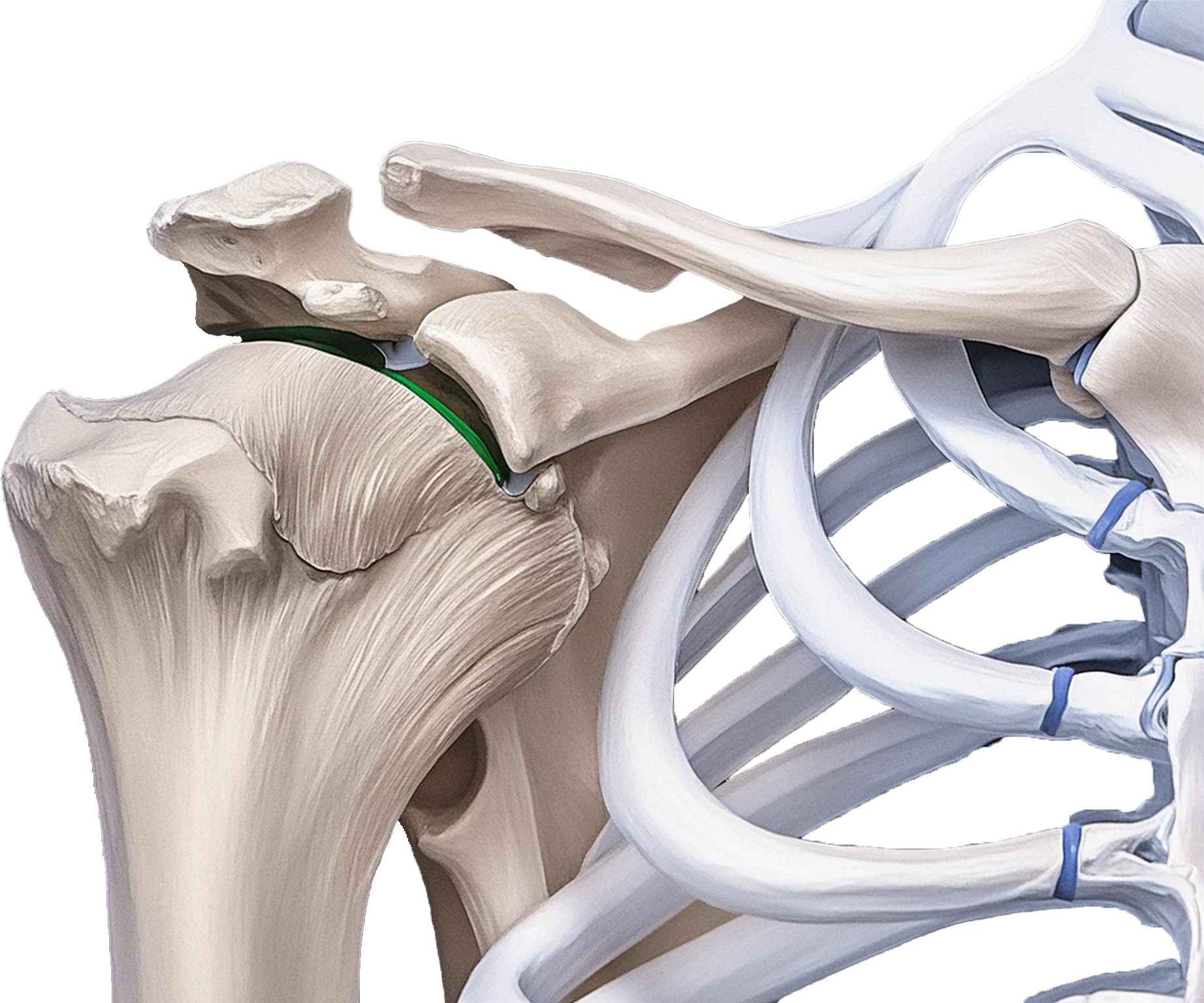 Darstellung des Acromioclavikular (ACG)